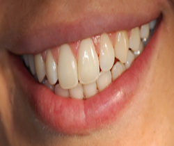 Odontoiatria Estetica